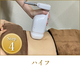 Step4｜ラジオ波